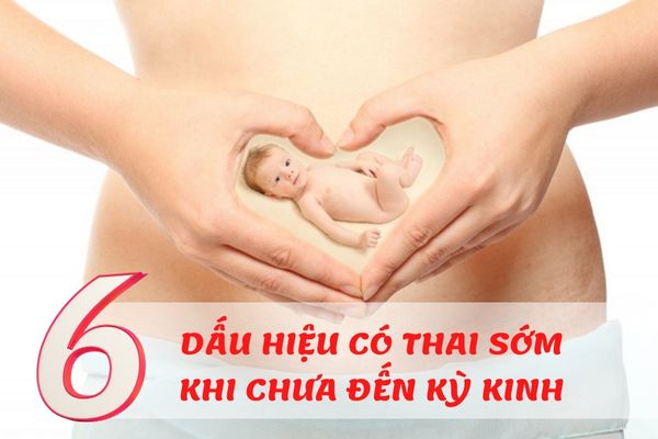 Bật mí 6 dấu hiệu có thai sớm khi chưa đến kỳ kinh mẹ bầu cần biết