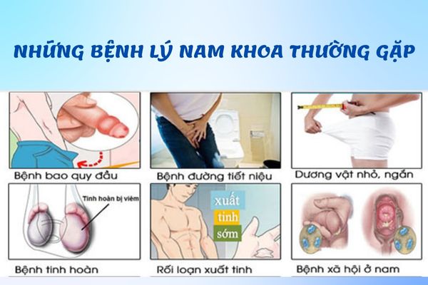 Các bệnh nam khoa phổ biến hiện nay