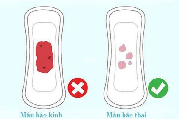 Chảy mủ ở nữ giới – Cảnh báo các bệnh lý nguy hiểm không nên bỏ qua