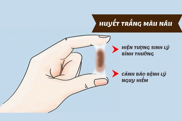 Huyết trắng màu nâu – Dấu hiệu cảnh báo bệnh lý phụ khoa nguy hiểm