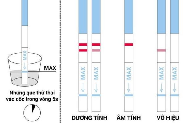 Nguyên nhân ngứa bao quy đầu – Cách điều trị hiệu quả