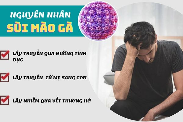 Sùi mào gà lây truyền qua nhiều con đường khác nhau