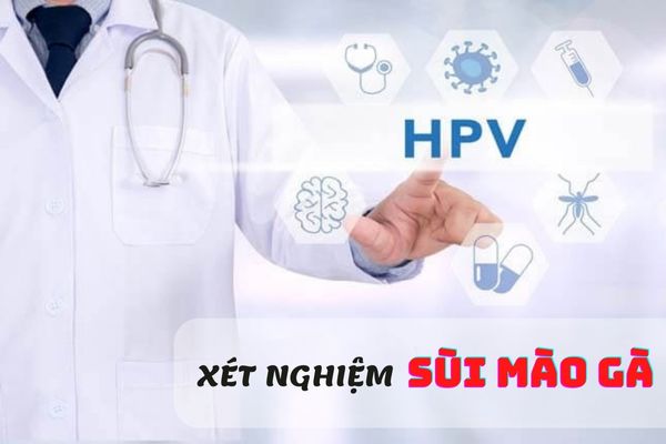 Xét nghiệm sùi mào gà – Phát hiện và điều trị bệnh kịp thời, hiệu quả