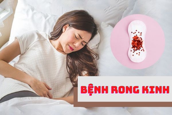 Dấu hiệu thừa bao quy đầu – Cách khắc phục hiệu quả và an toàn