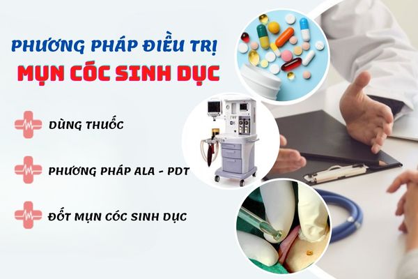 Phương pháp điều trị mụn cóc sinh dục hiệu quả