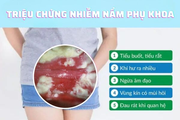 Xét nghiệm bệnh HPV là gì? Phương pháp xét nghiệm bệnh hiệu quả