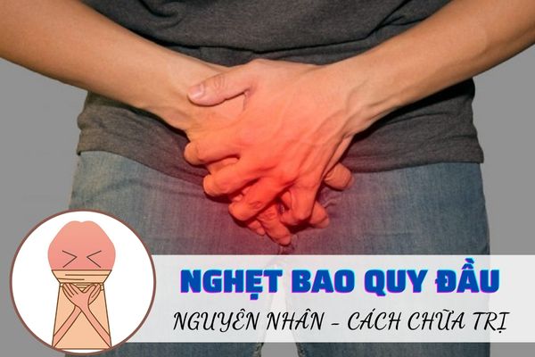 Nghẹt bao quy đầu – Dấu hiệu nhận biết và cách khắc phục