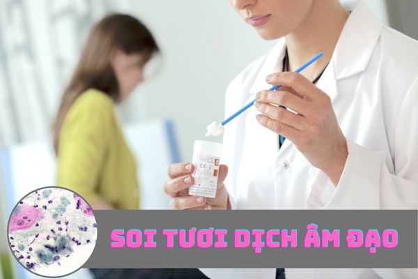 Soi tươi dịch âm đạo và những thông tin cần biết