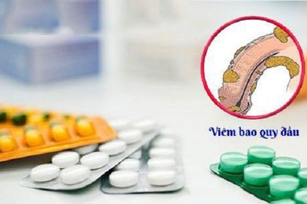 Thuốc chữa viêm bao quy đầu dạng uống