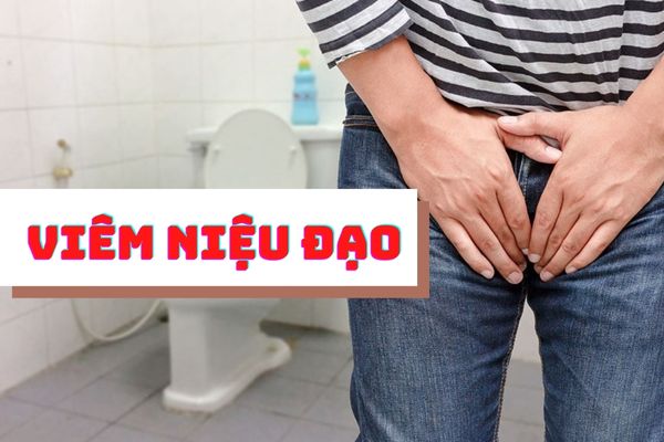 Đừng xem nhẹ viêm niệu đạo