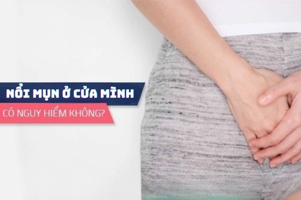 Nổi mụn ở cửa mình là bị bệnh gì? Có nguy hiểm không?