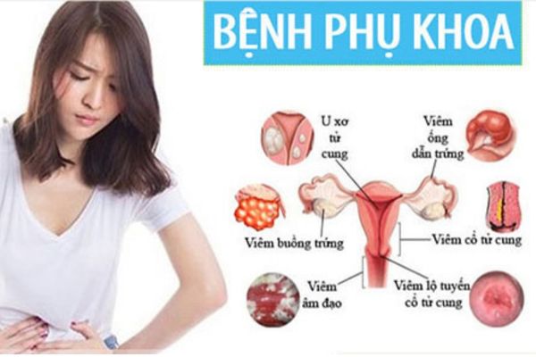 Trễ kinh cảnh báo nhiều bệnh phụ khoa nguy hiểm