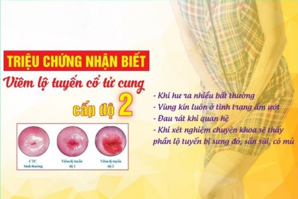 Địa chỉ chữa tinh trùng vón cục uy tín và chất lượng