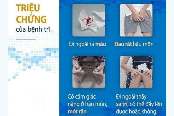 Một số dấu hiệu nhận biết bệnh trĩ thường gặp nhất