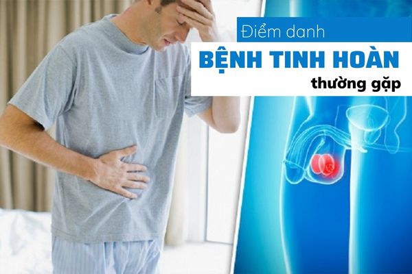 Cảnh báo một số bệnh tinh hoàn thường gặp