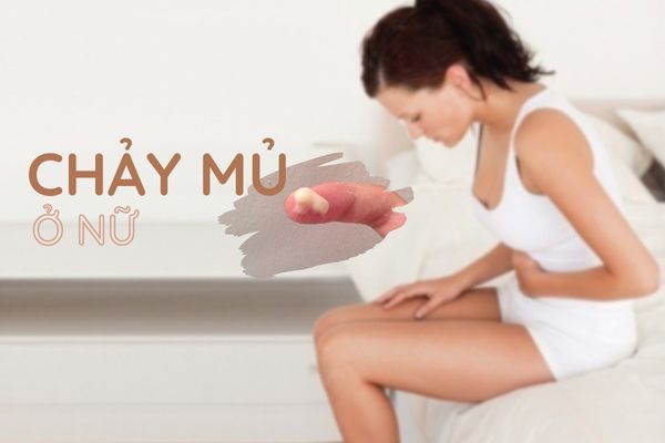 Chảy mủ ở nữ cảnh báo bệnh xã hội nguy hiểm