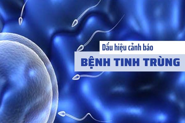 Dấu hiệu cảnh báo các bệnh tinh trùng ở nam giới