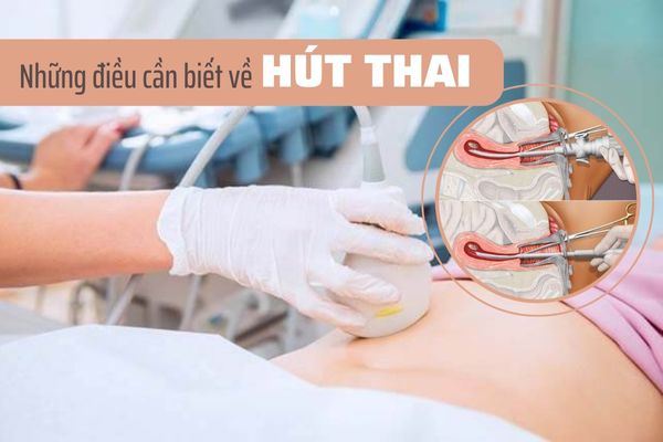 Hut-thai-va-nhung-dieu-can-luu-y