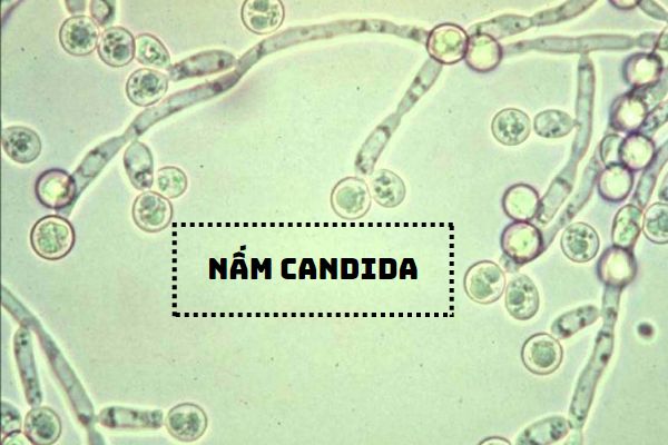 Những sự thật cần lưu ý về nấm Candida