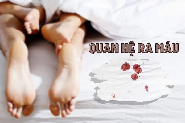 Quan hệ ra máu ở nữ là do đâu? Làm thế nào để khắc phục?