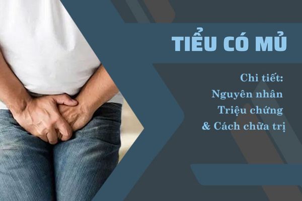 Tieu-co-mu-va-cach-dieu-tri-hieu-qua