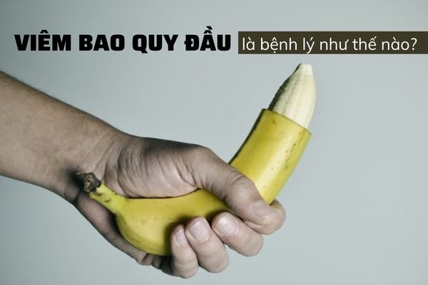 Viêm bao quy đầu: Bệnh lý cần điều trị sớm