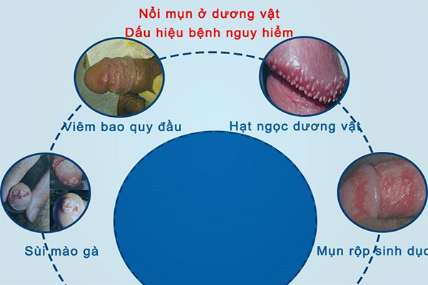 Noi-mun-o-duong-vat-la-benh-gi