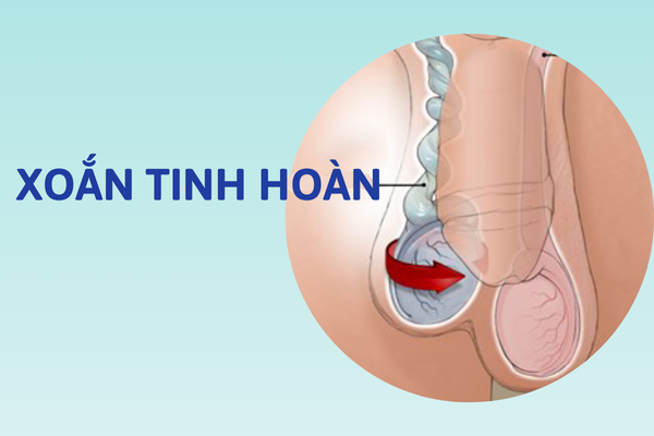 Benh-o-tinh-hoan-su-be-tac-lon-cua-phai-manh-3