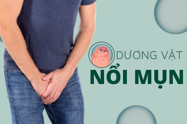 Cẩn trọng khi dương vật nổi mụn