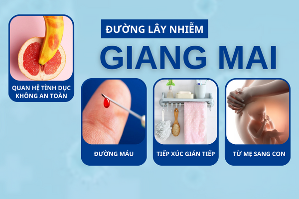 Giang mai ở nữ và sự thật cần biết