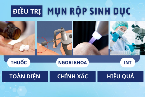 Mun-rop-sinh-duc-ban-co-thuc-su-hieu-ro-4