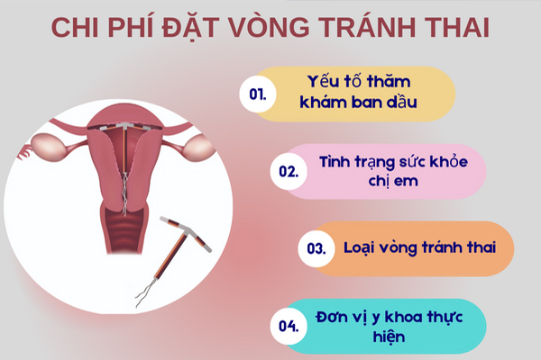 Chi phí đặt vòng tránh thai phụ thuộc vào nhiều yếu tố