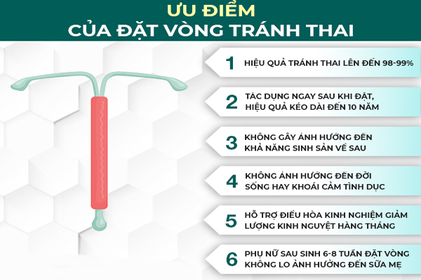 Đặt vòng tránh thai sở hữu nhiều ưu điểm nổi bật