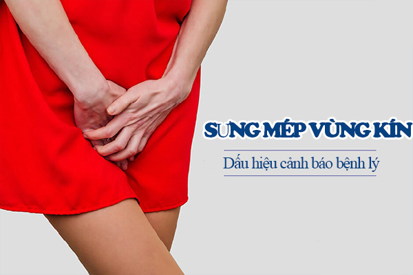 Sưng mép vùng kín dấu hiệu đáng ngờ của nhiều bệnh lý nguy hiểm