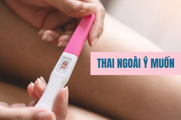 Thai ngoài ý muốn nên làm gì?