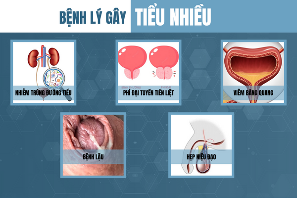 Tieu-nhieu-la-the-nao-va-nguyen-nhan-gi-gay-ra-2