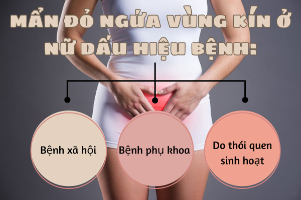 Mẩn đỏ ngứa vùng kín ở nữ - Dấu hiệu cảnh báo bệnh lý nguy hiểm