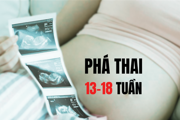 Phá thai 13-18 tuần an toàn