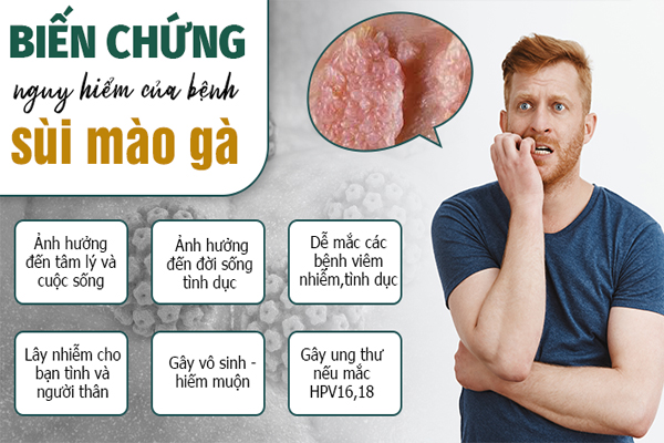 Tác hại sùi mào gà ở lỗ sáo gây ra