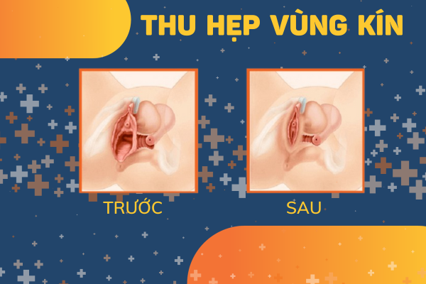 Thu-hep-vung-kin-ban-da-biet-chua-2