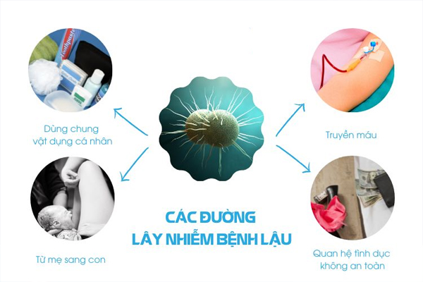 Những con đường lây nhiễm bệnh lậu cần biết