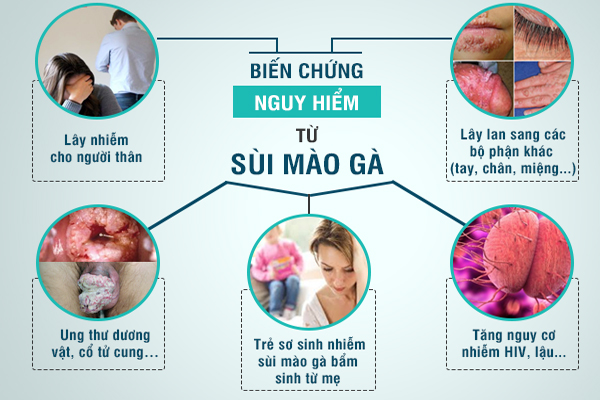 Biến chứng nguy hiểm khi nhiễm sùi mào gà gây ra