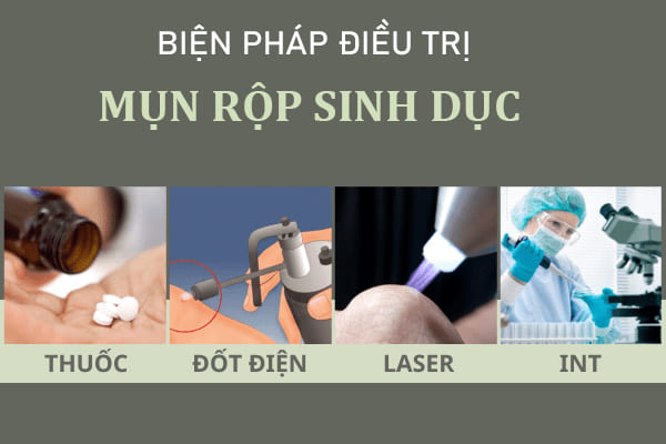 Dieu-tri-mun-rop-sinh-duc-nhu-the-nao-hieu-qua-2