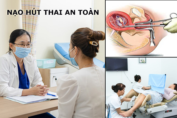 Nạo hút thai an toàn