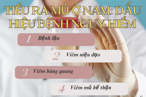 Tiểu ra mủ ở nam: Dấu hiệu bệnh nguy hiểm