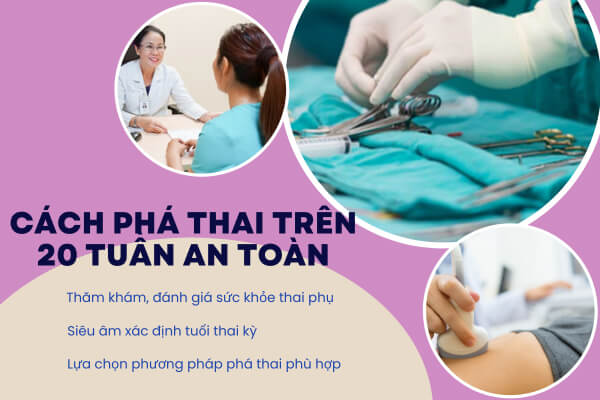 Cách phá thai trên 20 tuần an toàn