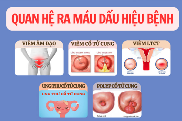 Quan hệ ra máu dấu hiệu cảnh báo nhiều bệnh lý nguy hiểm