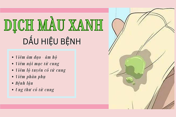 Dịch màu xanh dấu hiệu cảnh báo nhiều bệnh lý nguy hiểm