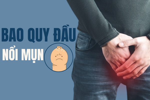 Đừng chủ quan khi bao quy đầu nổi mụn.