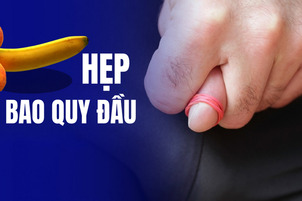 Hẹp bao quy đầu – Hội chứng nguy hiểm phổ biến ở nam giới.